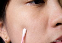 Derma Essence Clinic Sector 41 Noida