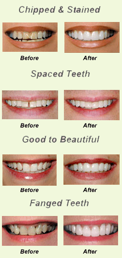 Sparkle Dental Clinic Kaushambi Ghaziabad