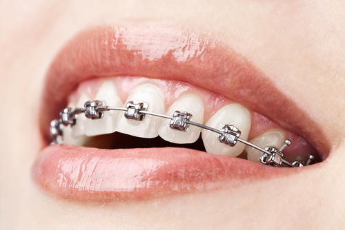 Garg Dental Clinic Jogeshwari East Mumbai