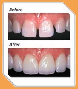 Prototype Dental Clinic Banjara Hills Hyderabad
