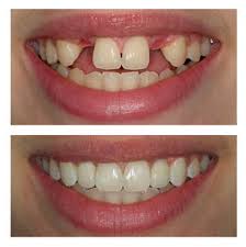 32 Dental Care Kalyan City Thane