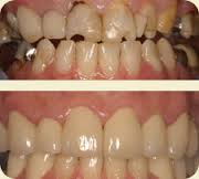 32 Dental Care Kalyan City Thane