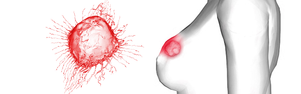 Sri Srinivasa Oncology Hospital Rajajinagar Bangalore