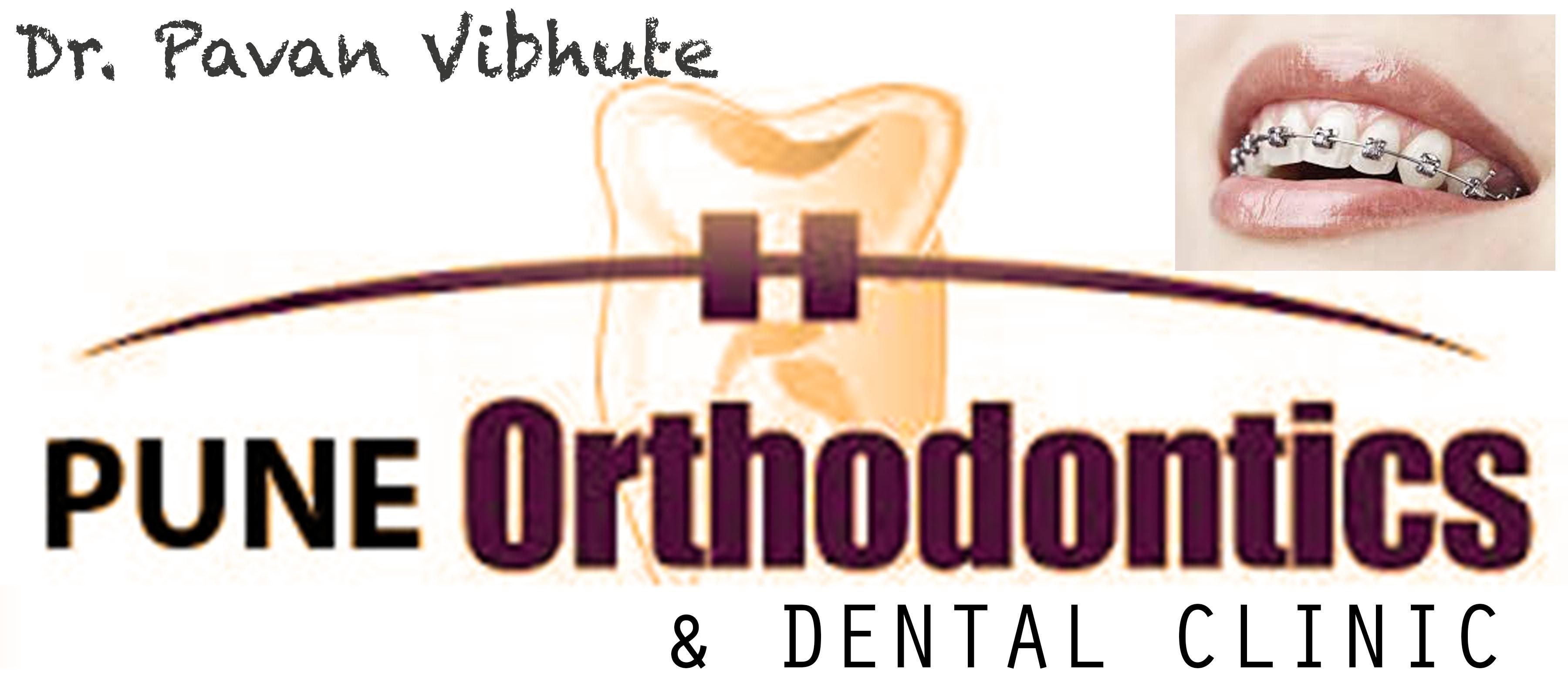 Braces & Implant Clinic