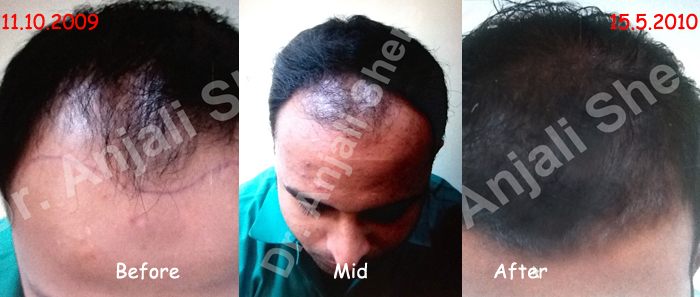 Hair Science Andheri Mumbai