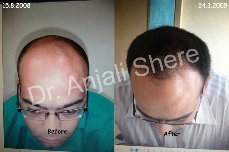 Hair Science Andheri Mumbai