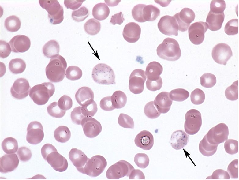 Rugved Pathology Laboratory Ghatlodia Ahmedabad