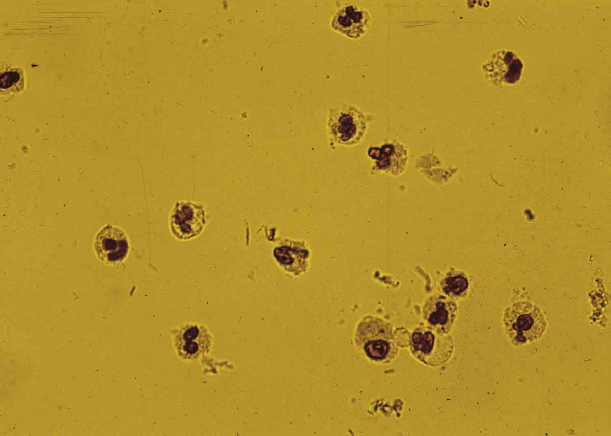 Rugved Pathology Laboratory Ghatlodia Ahmedabad