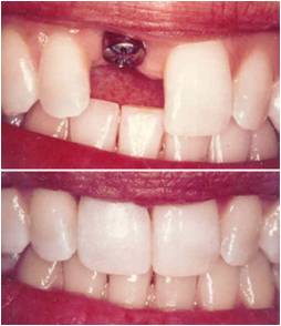 Indo American Dental Hospital Suryaraopet Vijayawada