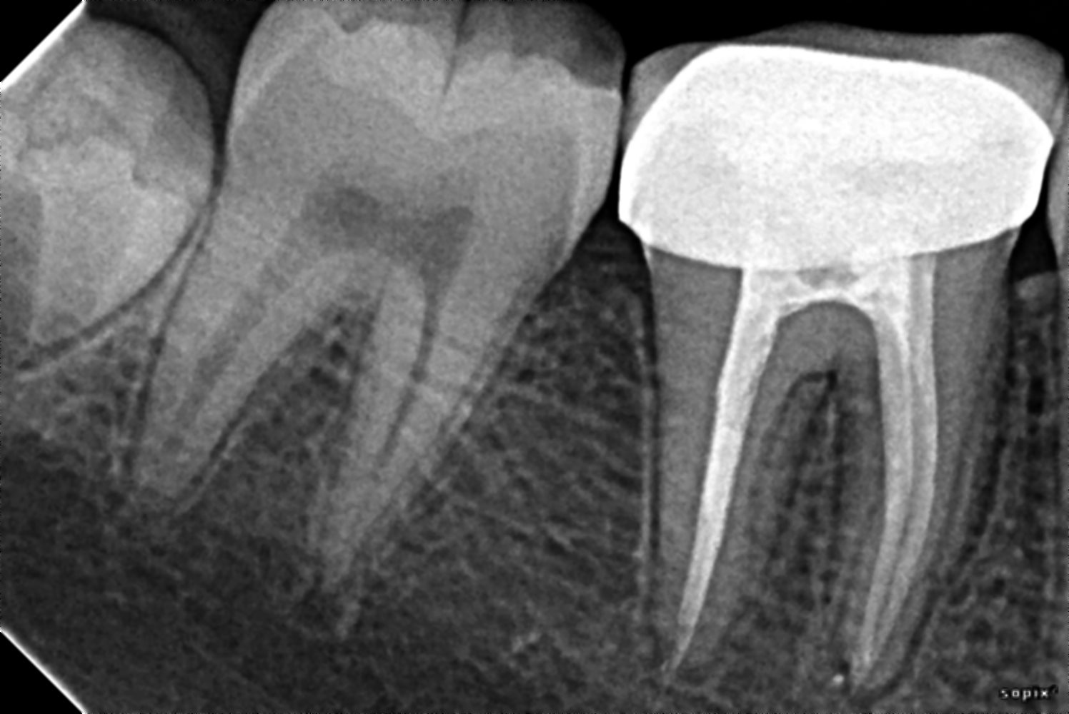 K.R Multi Speciality Dental Hospital. Mengles Road Dindigul