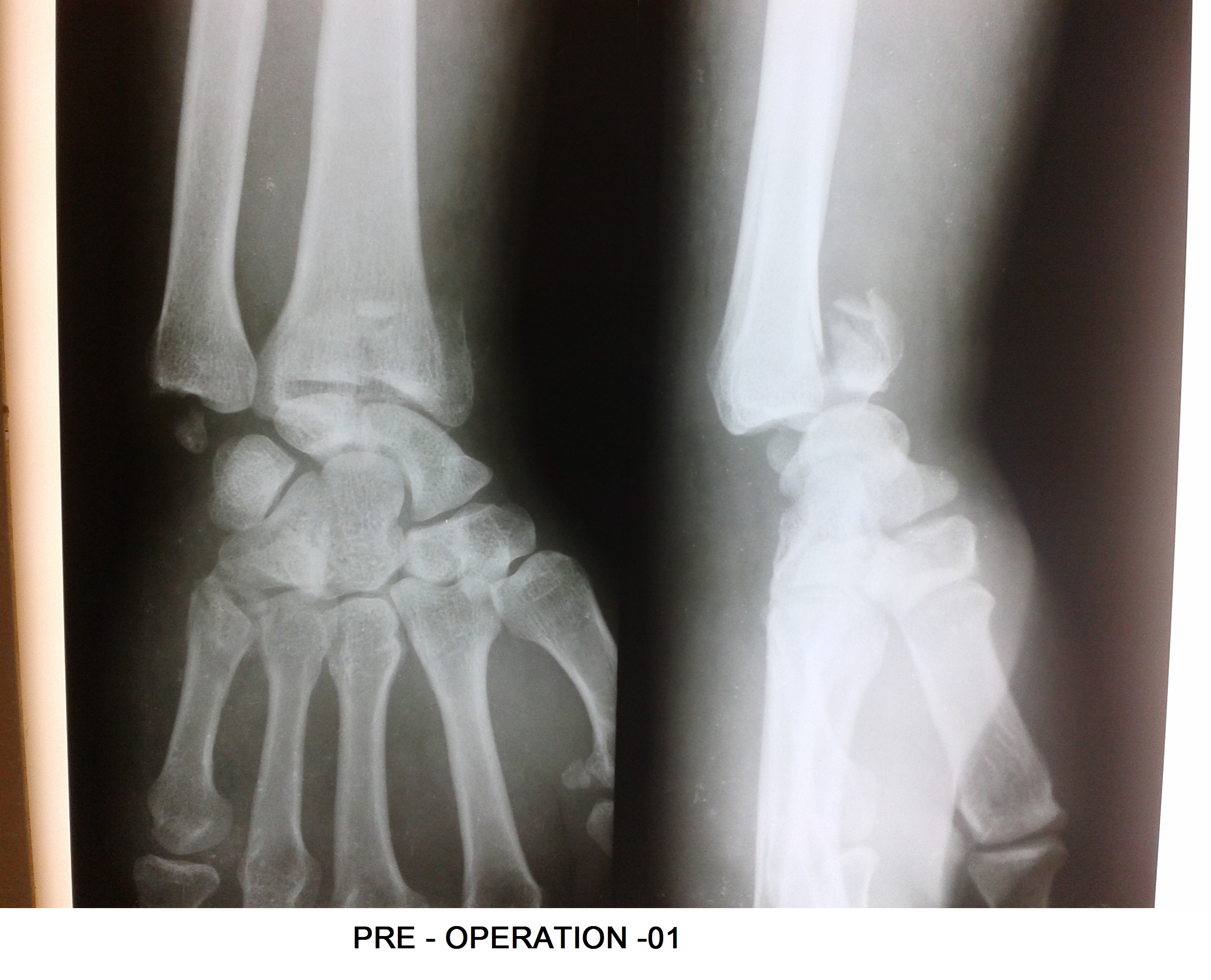 Dr. Dinesh Kasture's Ortho Clinic Kandivali West Mumbai