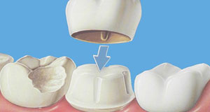 Chandraj Oral And Dentofacial Clinic Mansarovar Jaipur