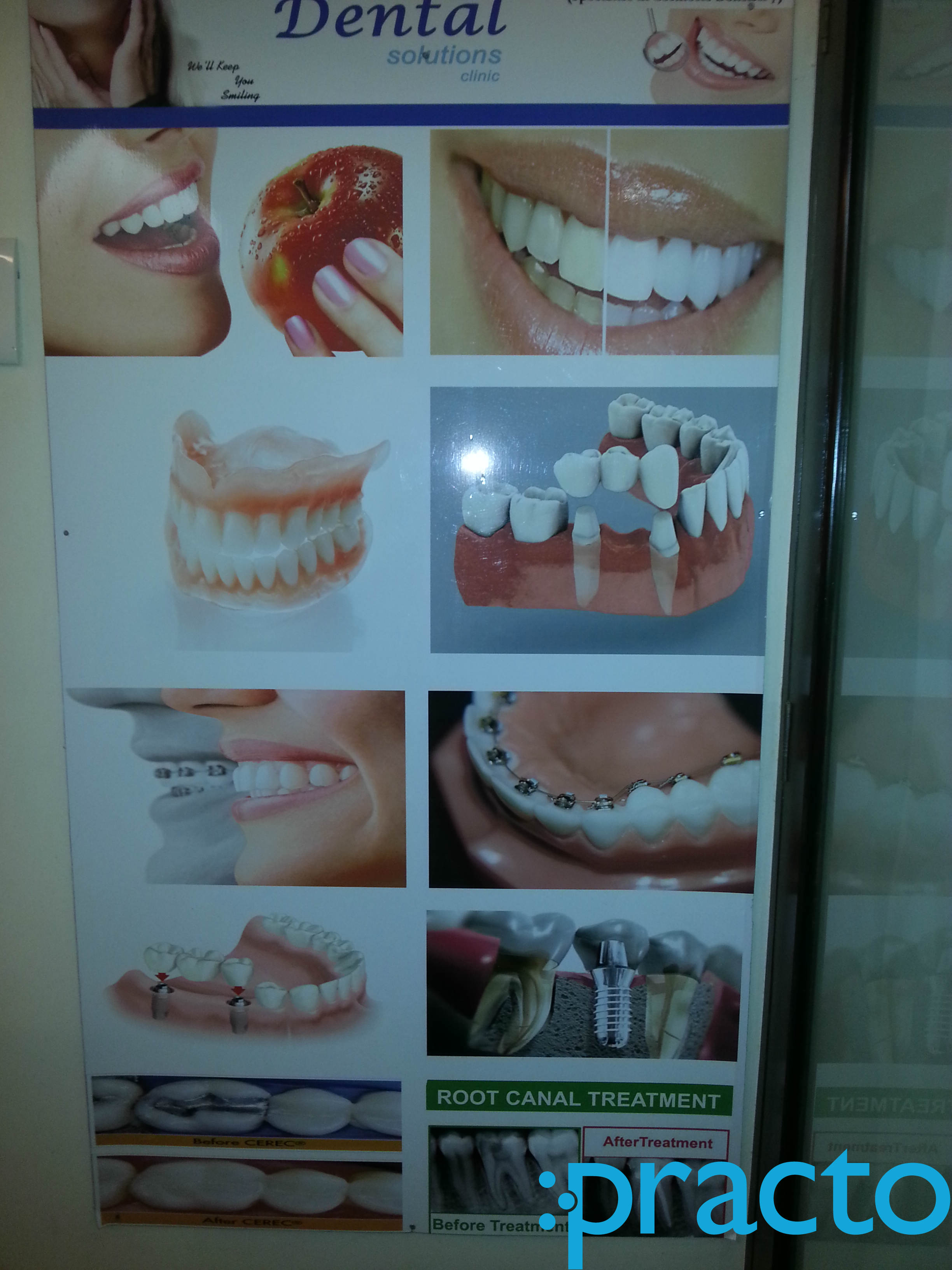 Dental Solutions Andheri West Mumbai