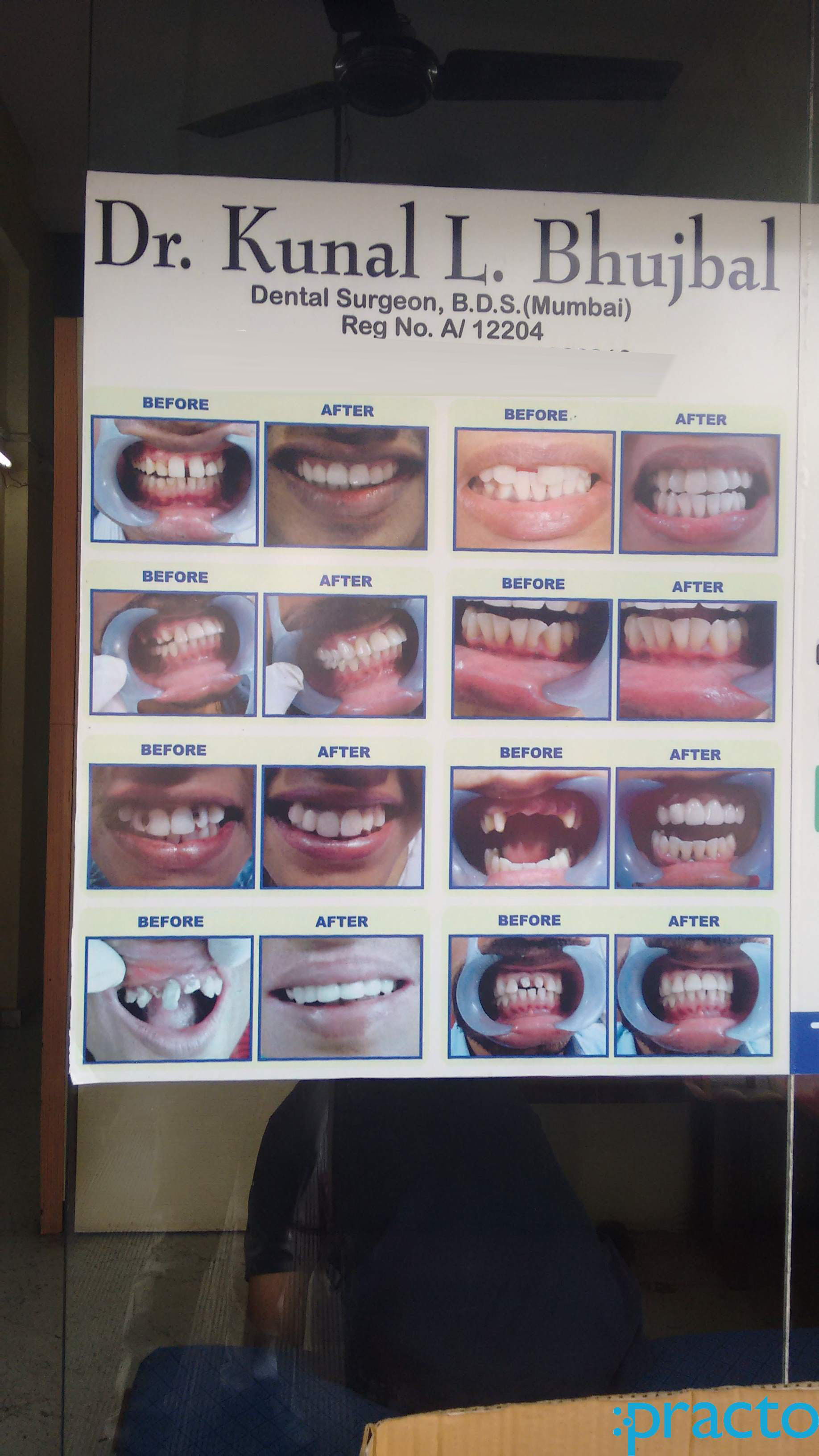 Dr. Bhujbal's Dental Clinic Kopar Khairne Navi Mumbai