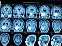 Dr.Kaustubh Dindorkar's Brain & Spine Surgery Clinic Erandwane Pune