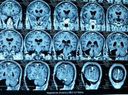 Dr.Kaustubh Dindorkar's Brain & Spine Surgery Clinic Erandwane Pune