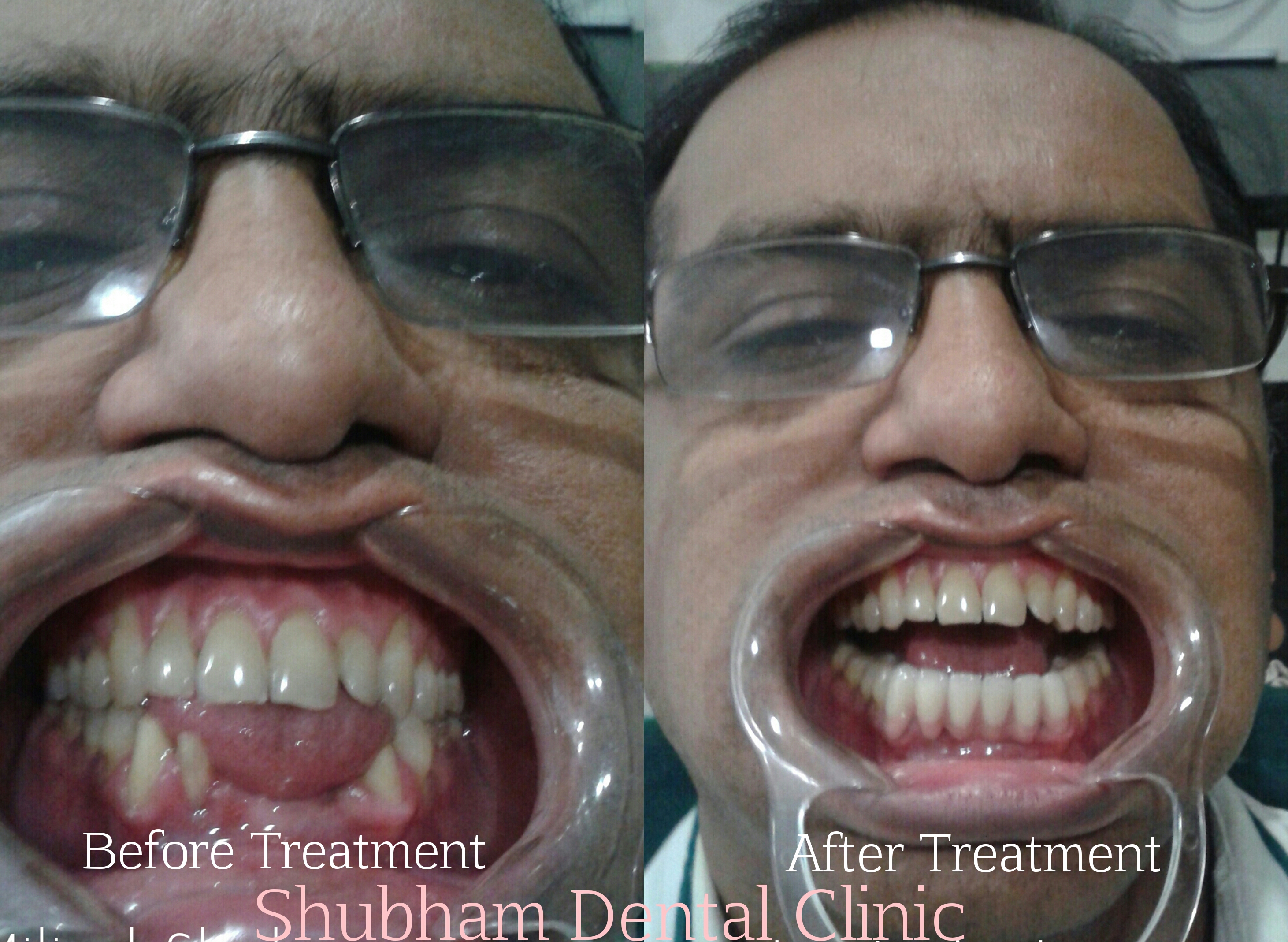 Shubham Dental Clinic & Implant Centre Subhanpura Vadodara