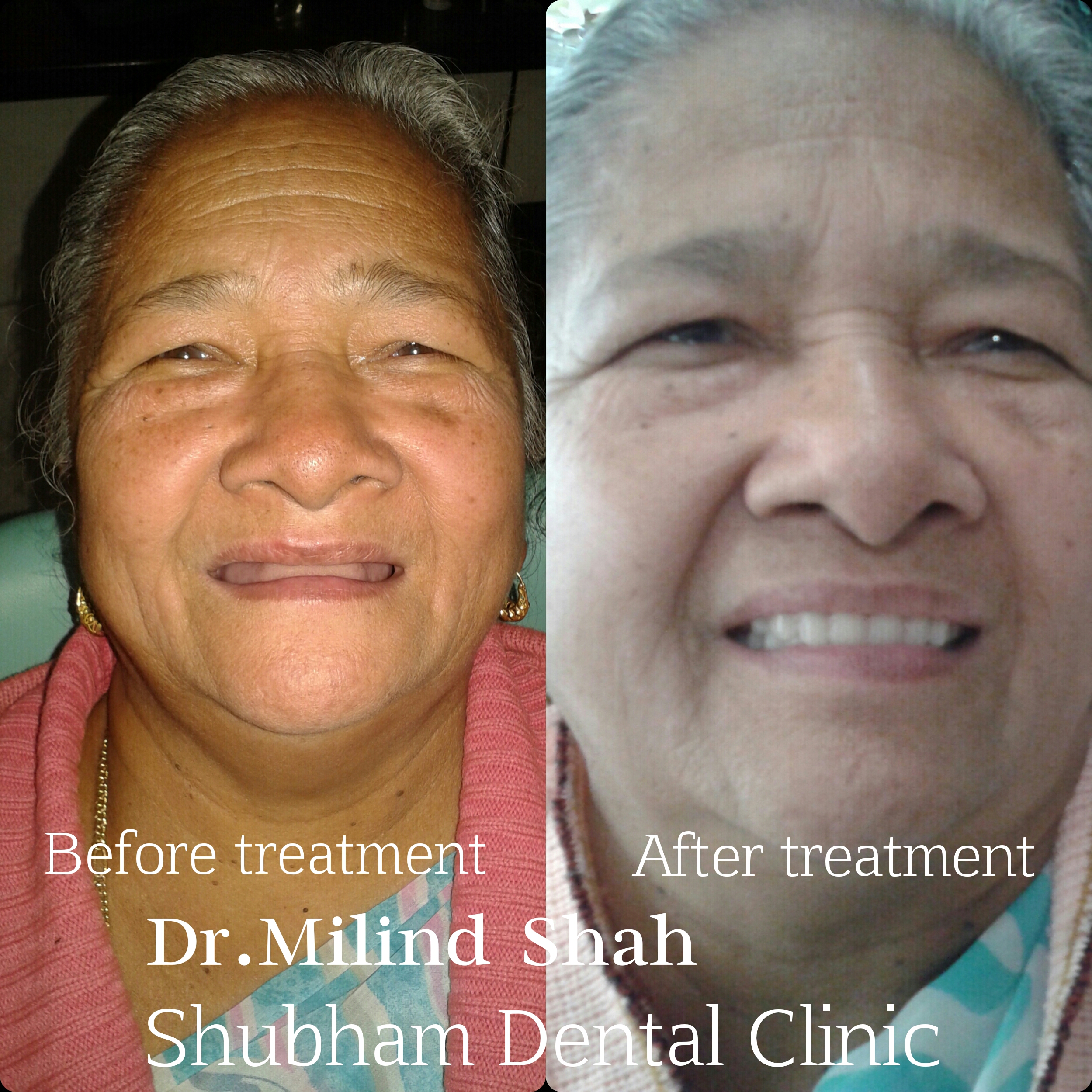 Shubham Dental Clinic & Implant Centre Subhanpura Vadodara