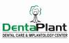 DentaPlant