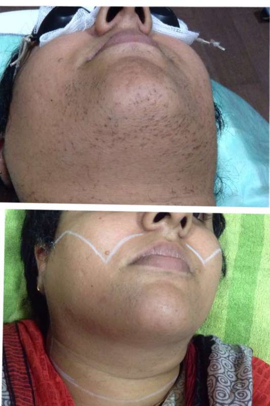 Aarthi Skin Care Clinic And Laser Centre, Skin Clinic in 