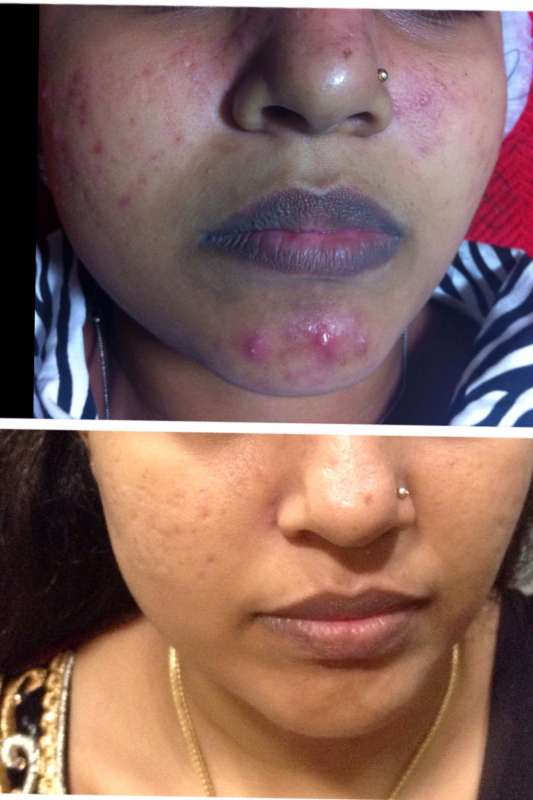 Aarthi Skin Care Clinic And Laser Centre, Skin Clinic in 
