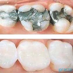 SmileWorks Dental Studio Andheri Mumbai