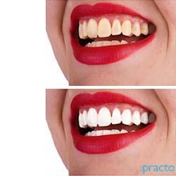 SmileWorks Dental Studio Andheri Mumbai