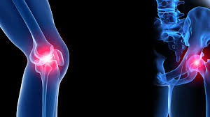 Fracture And Joint Orthopaedic Clinic Kalyan Nagar Bangalore
