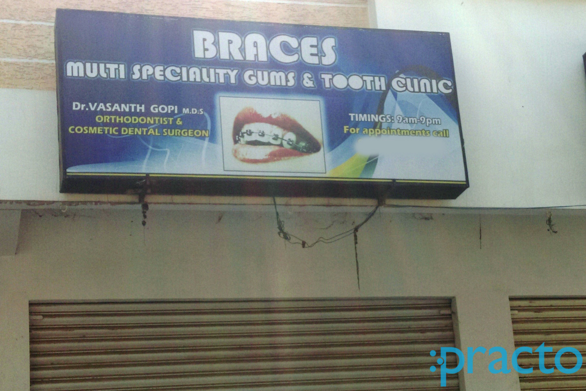 Braces Multi Speciality Tooth Clinic Dilsukhnagar Hyderabad