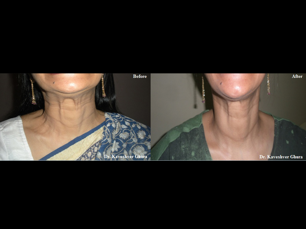 Others at Skin Image Sector 17 Faridabad