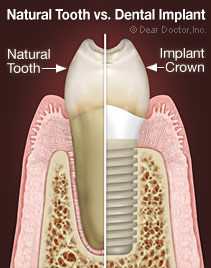 Rohini Dental Care Gurgaon Sector 31 Gurgaon