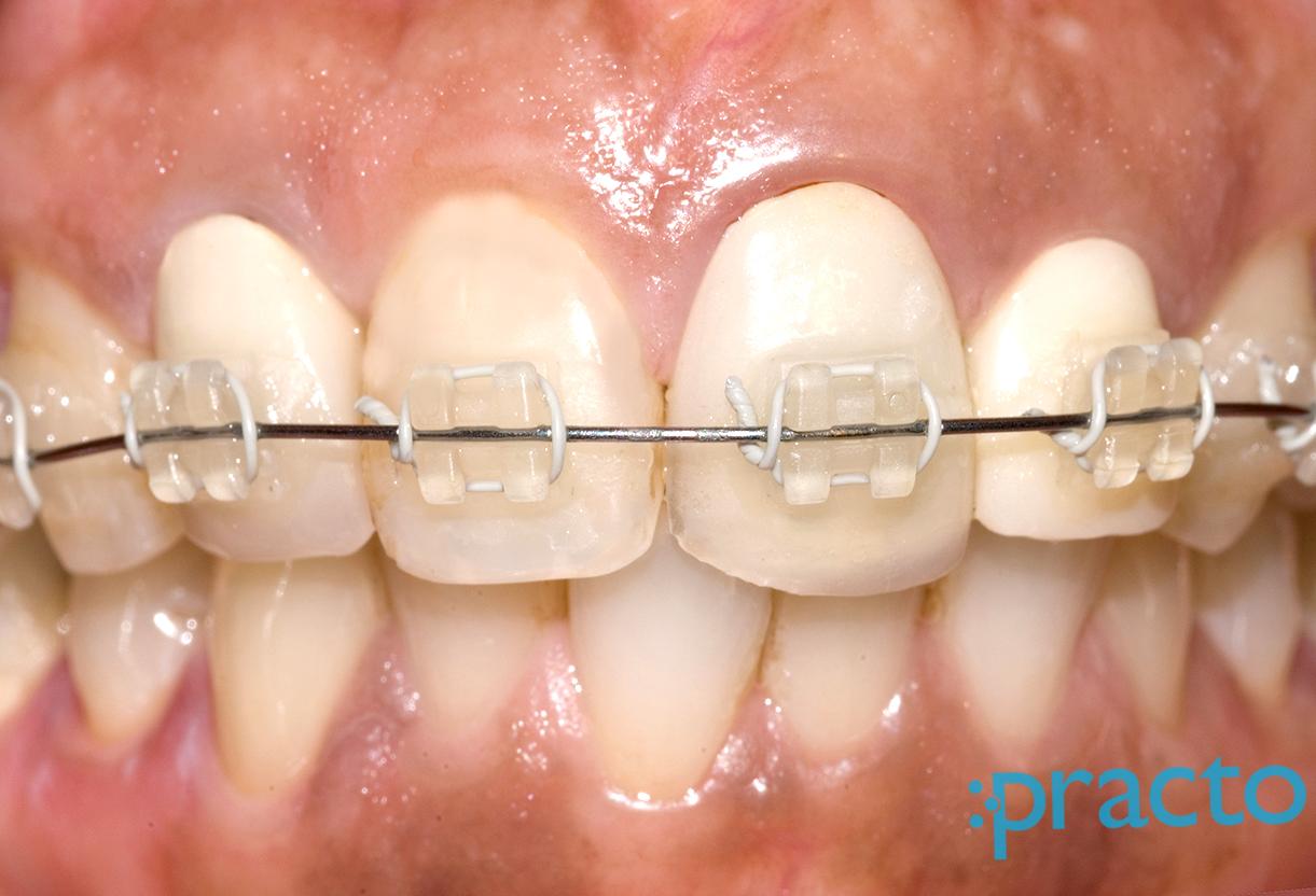 Jeyam Dental Clinic Ashok Nagar Chennai