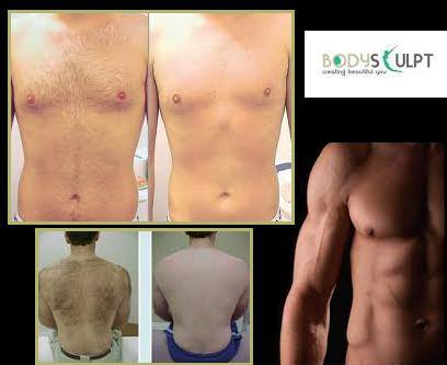 Body Sculpt Sector-51 Chandigarh