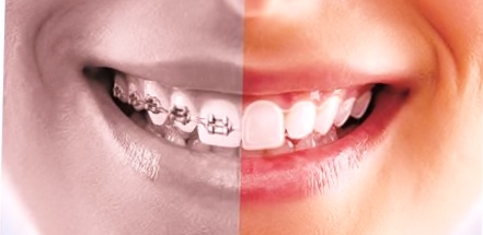 Entrance at Dr Mathesul Invisalign Orthodontist Braces and Dental Implant Clinic Kalyani Nagar Pune