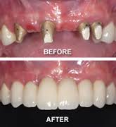 Perfect Dental Clinic Govindpura Bhopal