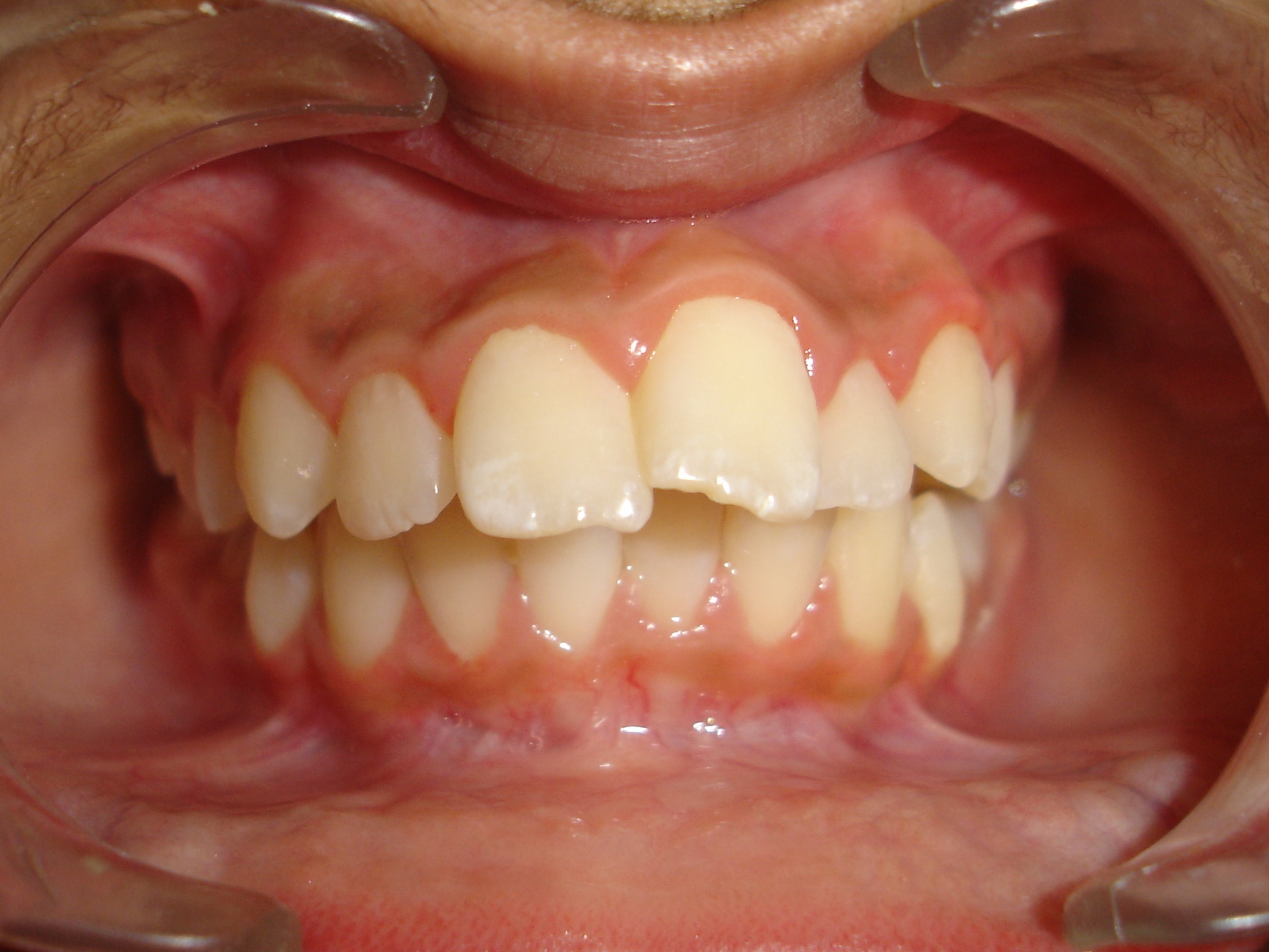 Dr Mona Prabhakar's Orthodontic Clinic Gurgaon Sector 31 Gurgaon
