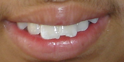 Dr Mona Prabhakar's Orthodontic Clinic Gurgaon Sector 31 Gurgaon