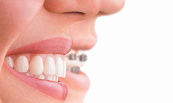 Sandhya Dental And Braces Clinic