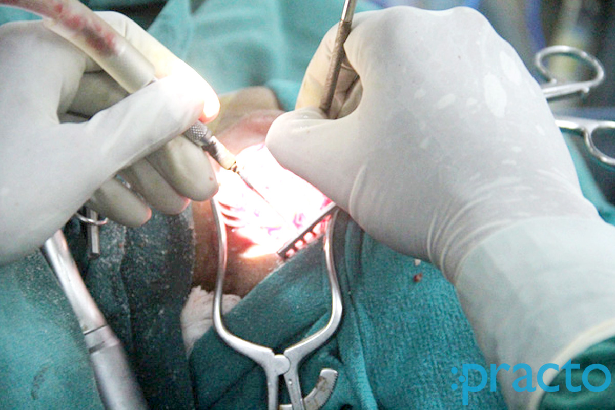 Operation Theatre at Dr. Abhishek Kumar's Clinic Upper Bazar Ranchi