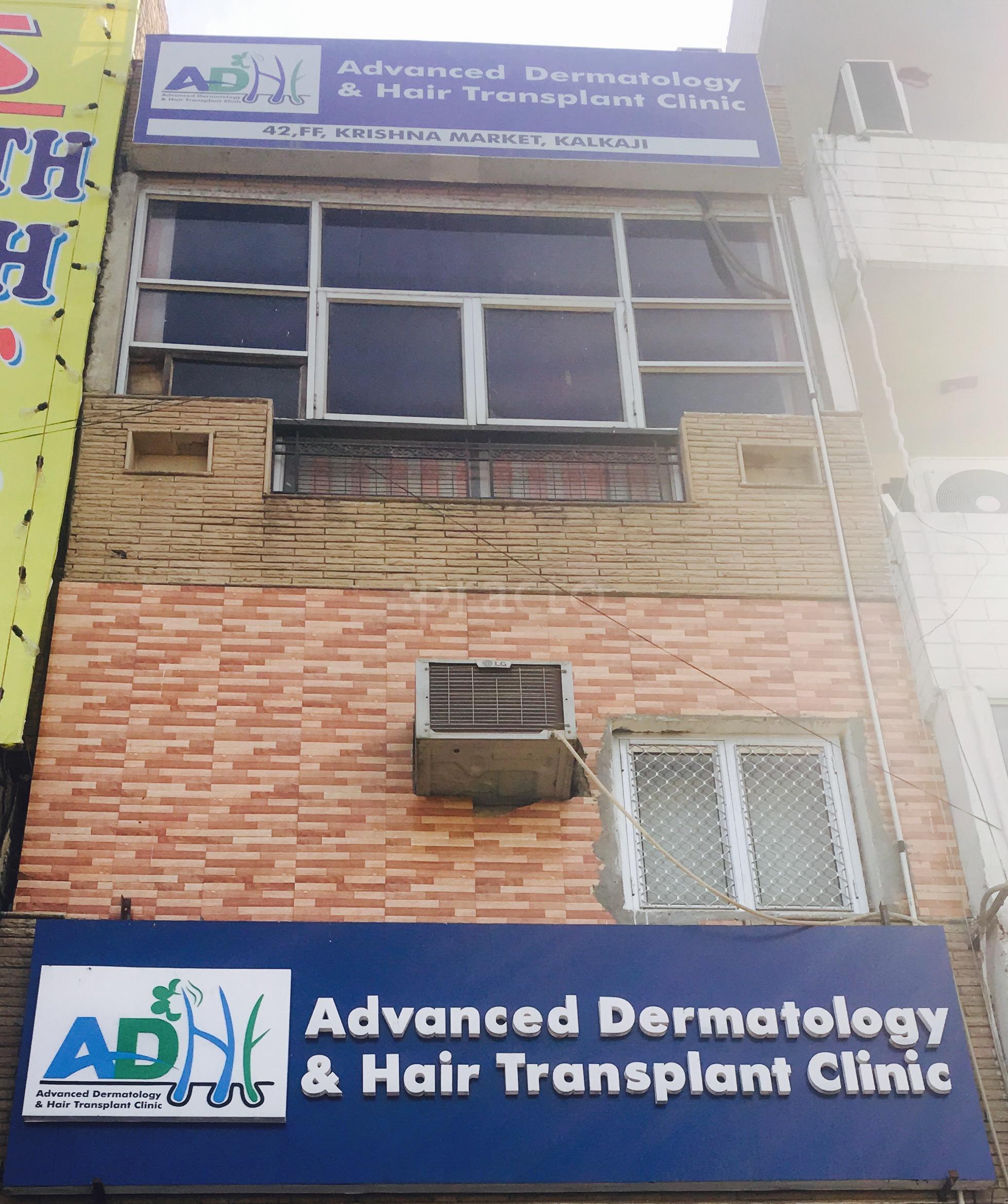Hair Transplant In Delhi Hair Transplant Cost Find Best Reviewed