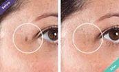 KJN Skin & Laser Clinic Kilpauk Chennai