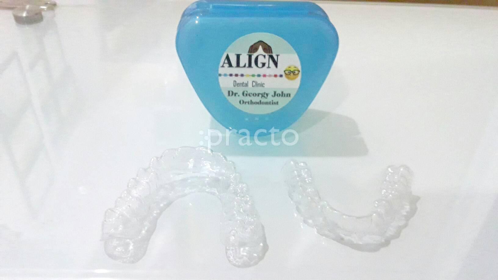 Others at Align Dental Clinic Chembur Mumbai