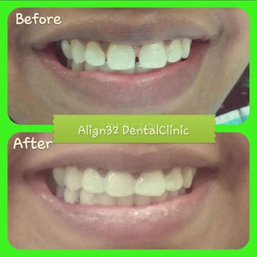 Align32 DentalClinic Gurukul Road Ahmedabad