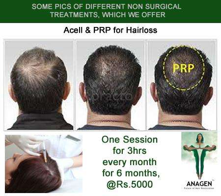 Anagen Hair Transplant, Hair Transplant Surgery Clinic in Andheri West, Mumbai - Book Appointment, View Fees, Feedbacks | Practo Anagen Hair Transplant, Hair Transplant Surgery Clinic in Andheri West, Mumbai - Book Appointment, View Fees, Feedbacks | Practo