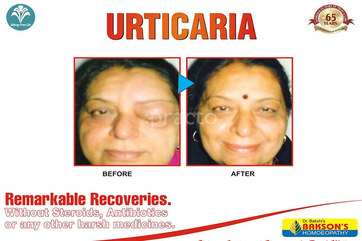 Others at Bakson's Homoeopathic Centre for Allergy South Extension 1 Delhi