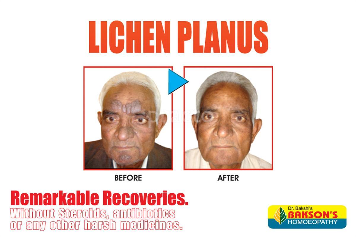 Others at Bakson's Homoeopathic Centre for Allergy Janakpuri Delhi