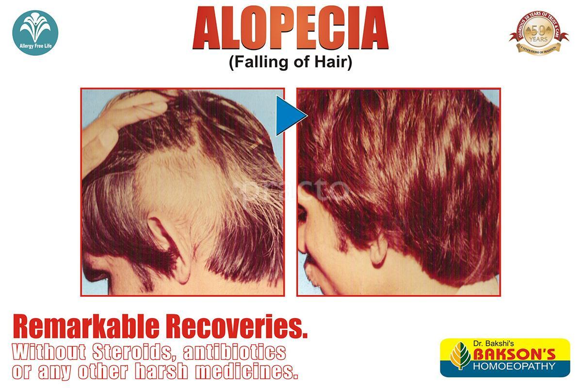 Others at Bakson's Homoeopathic Centre for Allergy Indirapuram Ghaziabad