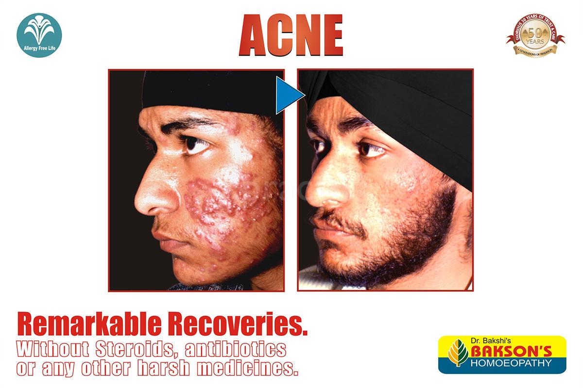 Others at Bakson's Homoeopathic Centre for Allergy Sohna Road Gurgaon