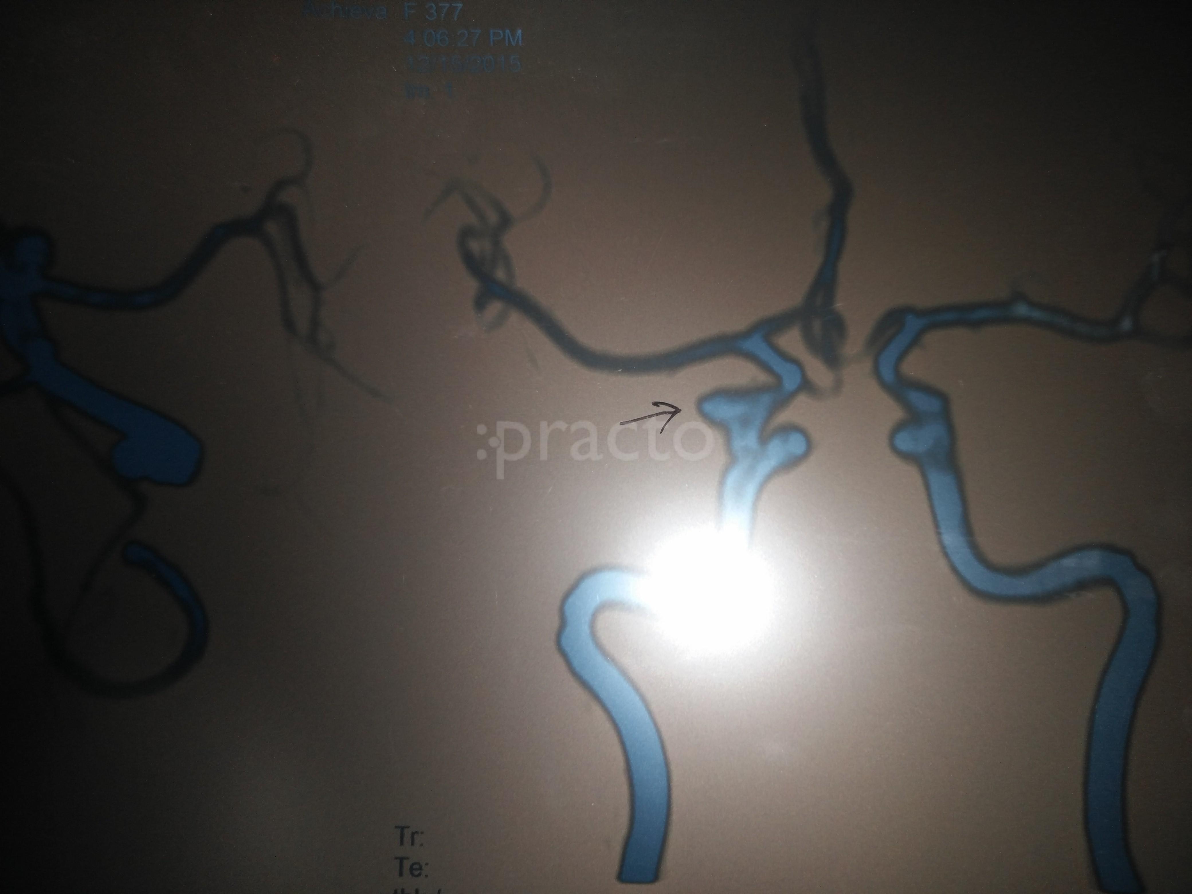 Brain And Spine Clinic Udham Singh nagar Ludhiana