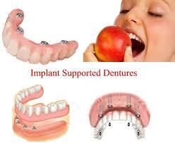 Chandranand Dental Clinic Shreshtha Vihar Delhi